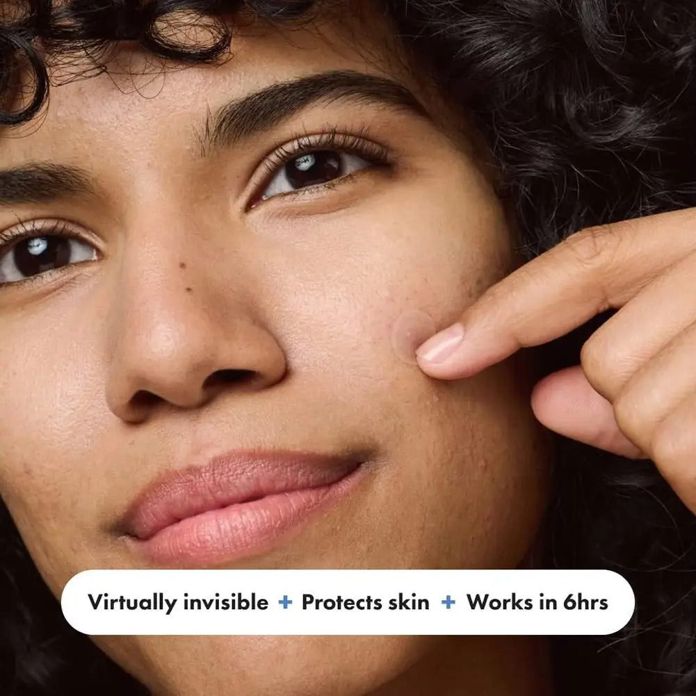 Invisible Pimple Patch – 400 pcs