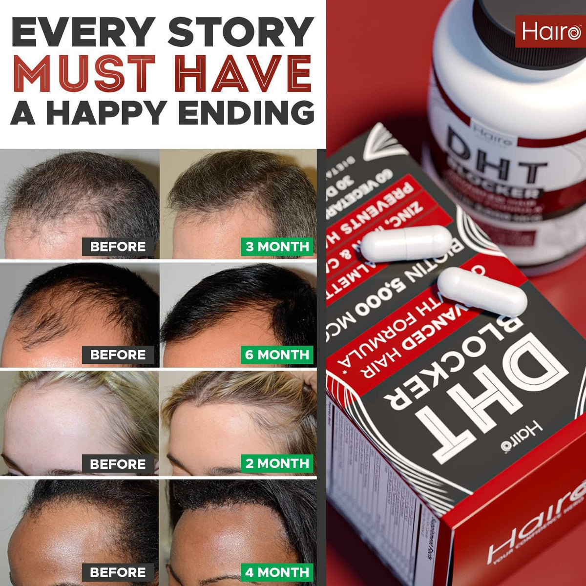 DHT Blocker Hair Growth Supplement - High Potency Biotin & Saw Palmetto