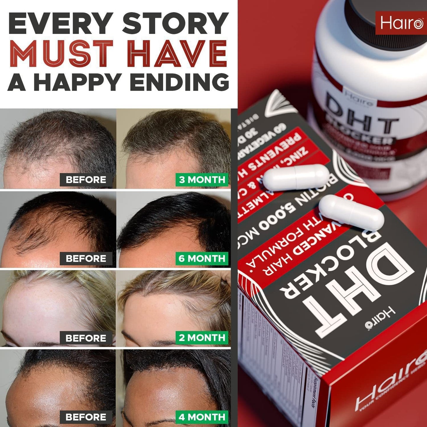 DHT Blocker Hair Growth Supplement - High Potency Biotin & Saw Palmetto